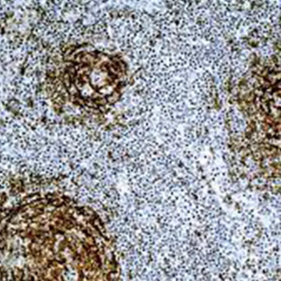 IHC - Cluster of Differentiation 23 (CD23)